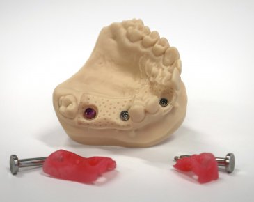 Dentálne modely