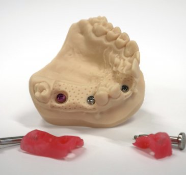 Dentální modely | cotu